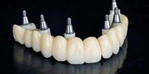 威兰德臻瓷ZENOSTAR氧化锆，引领齿科修复领域新潮流