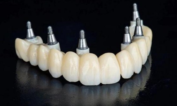 威兰德臻瓷ZENOSTAR氧化锆，引领齿科修复领域新潮流